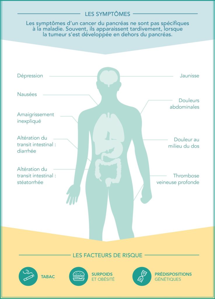 Infographie sur les symptômes du cancer du pancréas