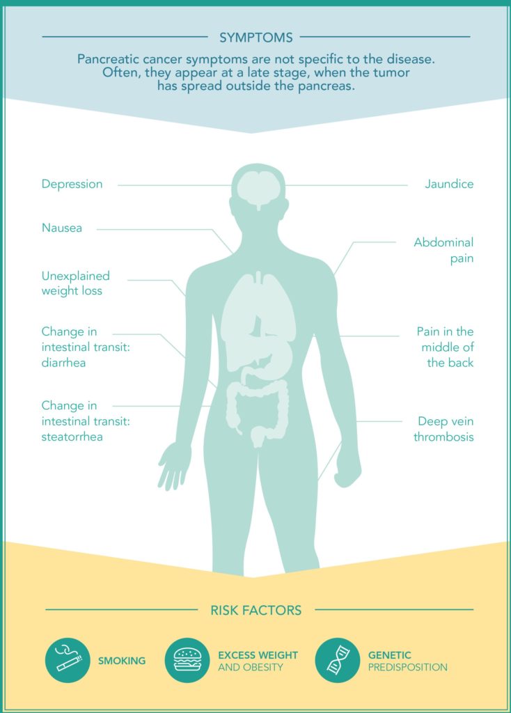 Infographic on the symptoms of pancreatic cancer