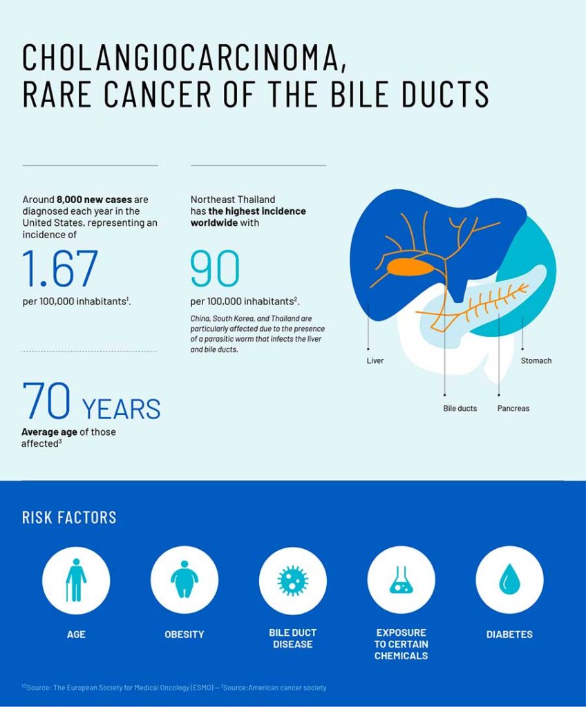 symptoms of bile duct cancer