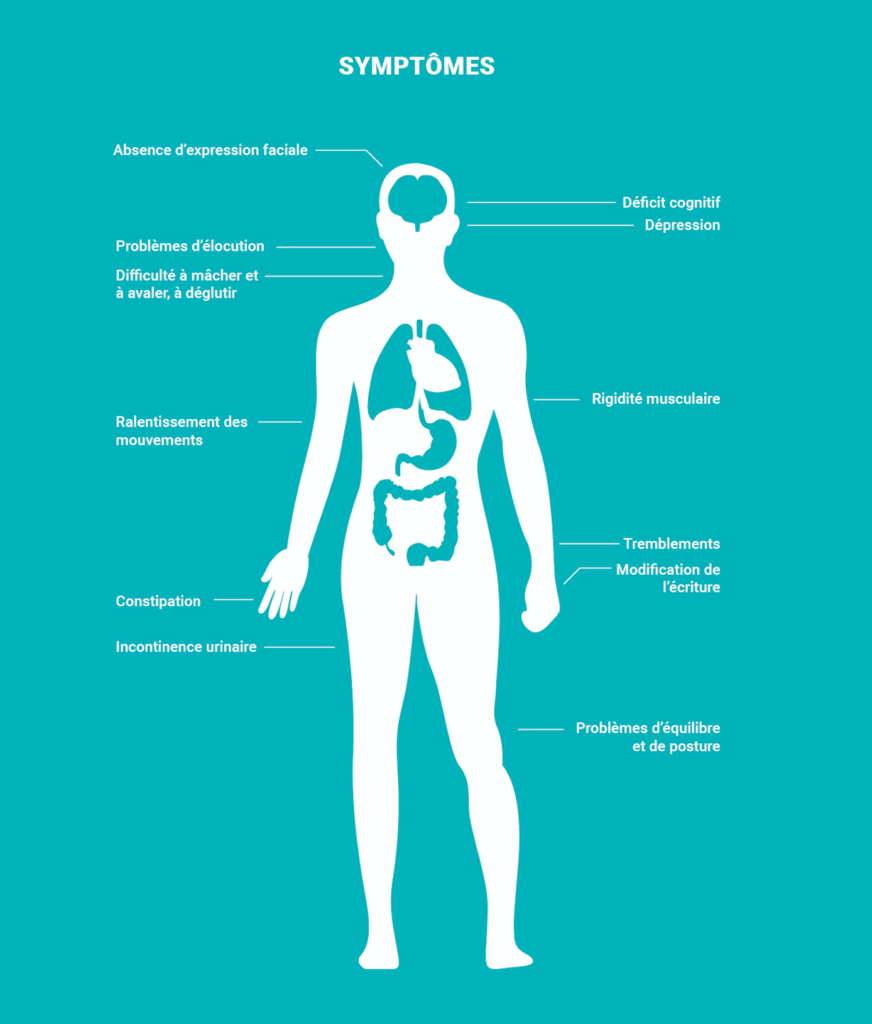 Infographie des symptômes du syndrome de Parkinson