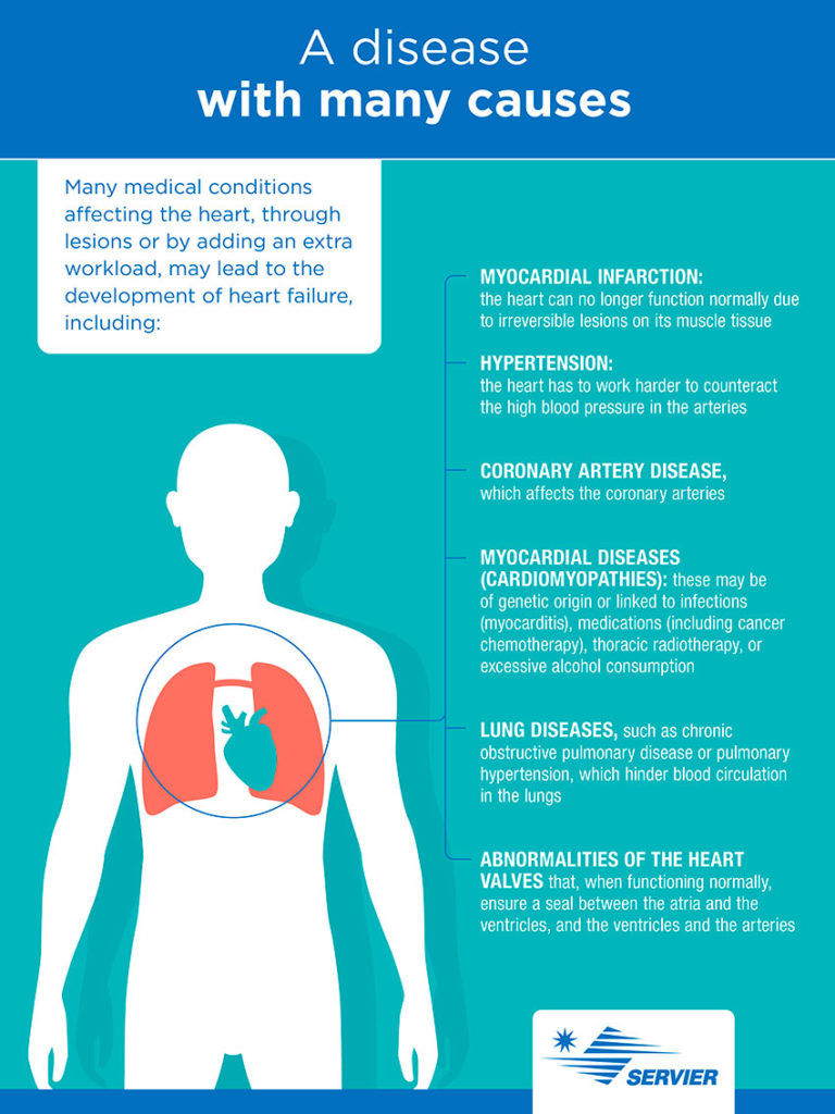 Infographic on the causes of heart failure